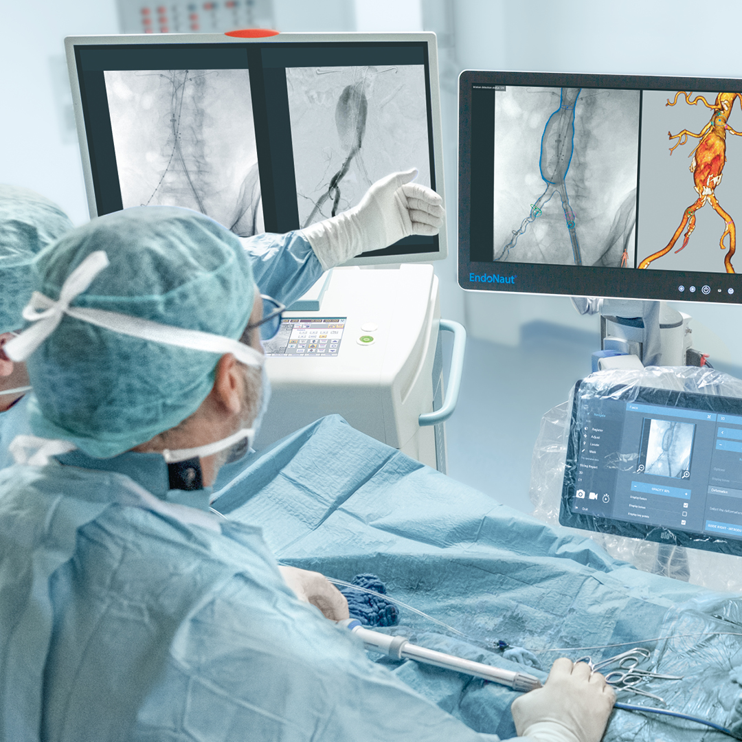 Vascular 3D Image Fusion with EndoNaut